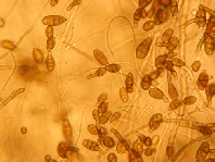 Alternaria solani